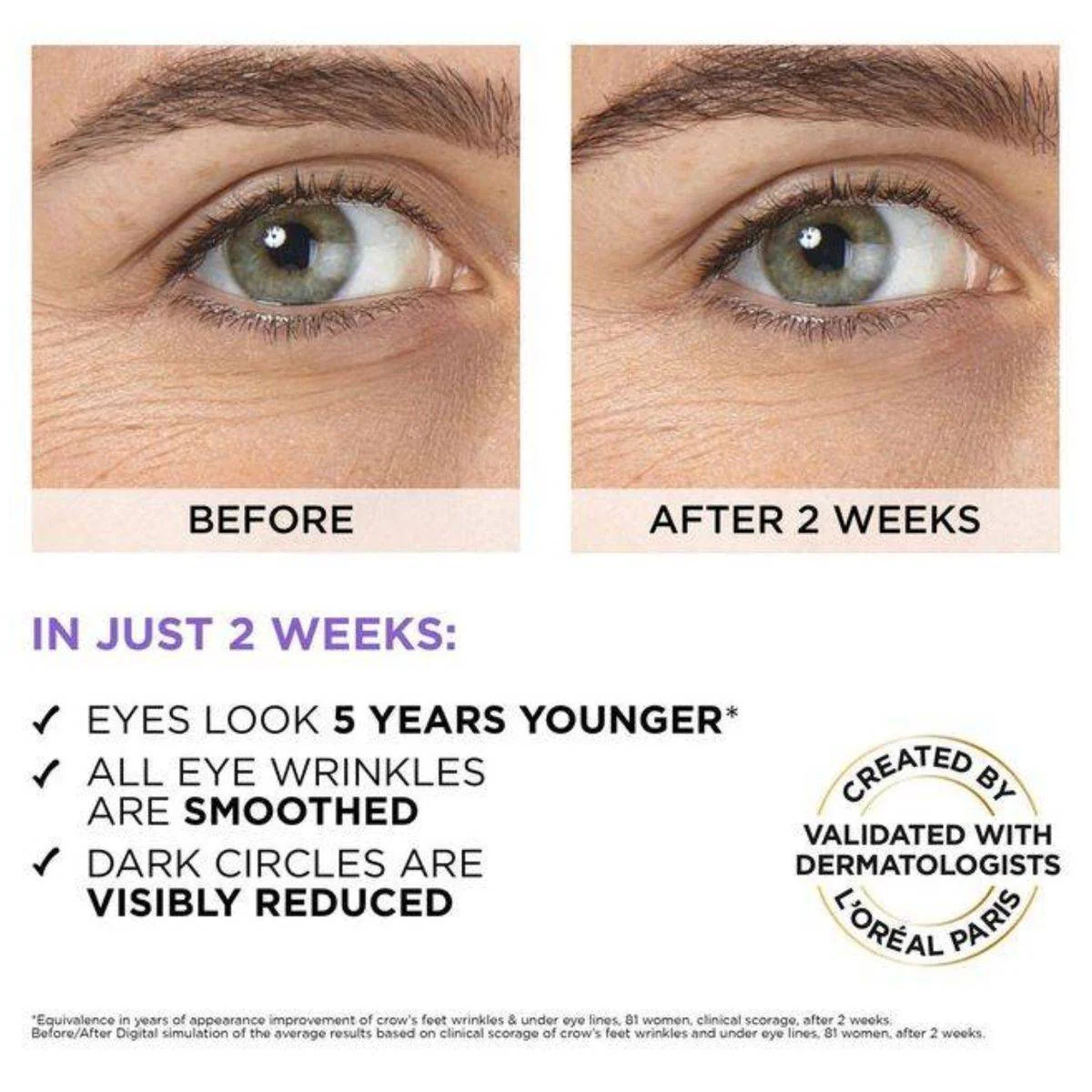 Loreal Paris Hyaluron Expert Hyaluronic Acid Eye Serum 20ml - Image 3