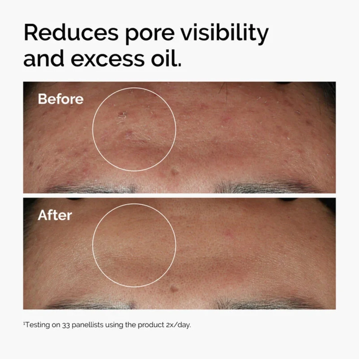 The Ordinary Niacinamide 10% + Zinc 1% Serum 60ml - Image 4